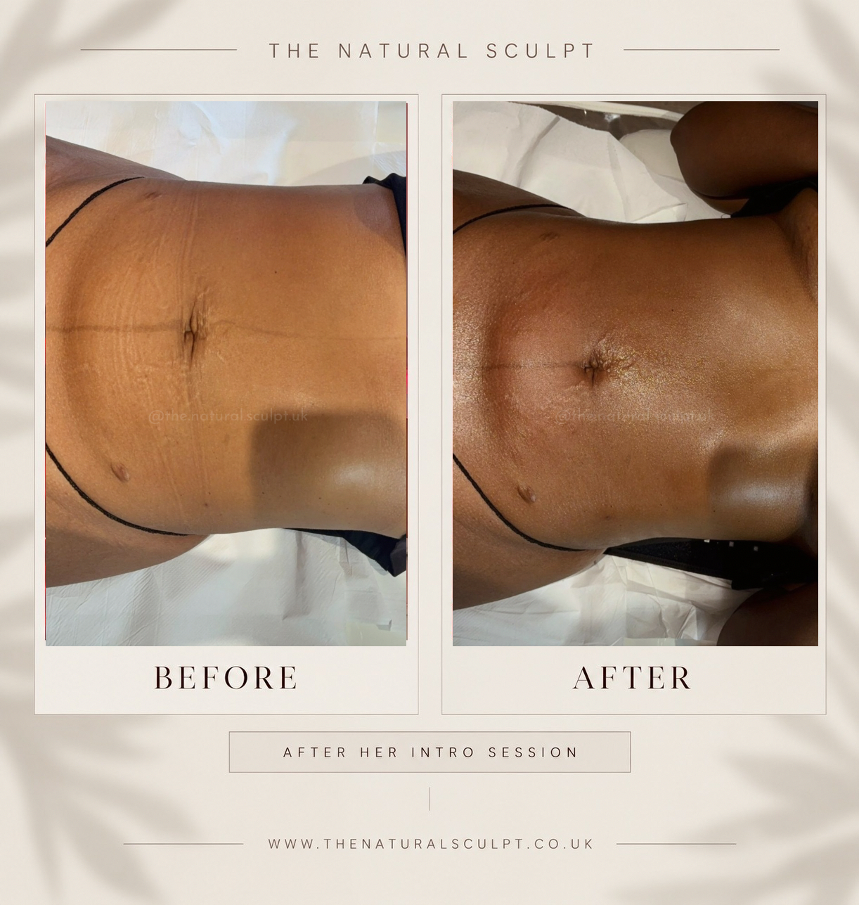 Before and after body sculpting at The Natural Sculpt, London