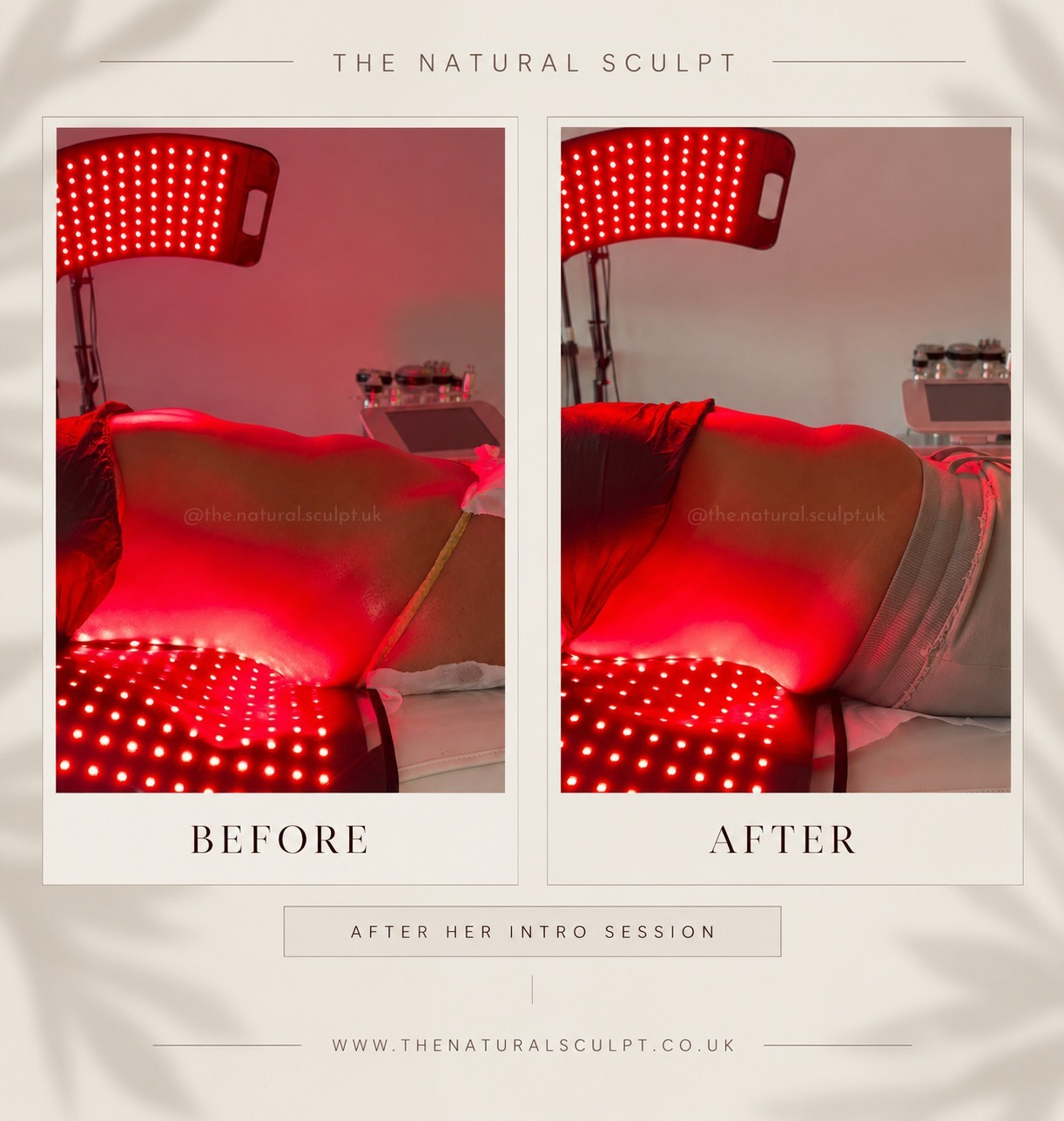 Signature Sculpt session at The Natural Sculpt, London