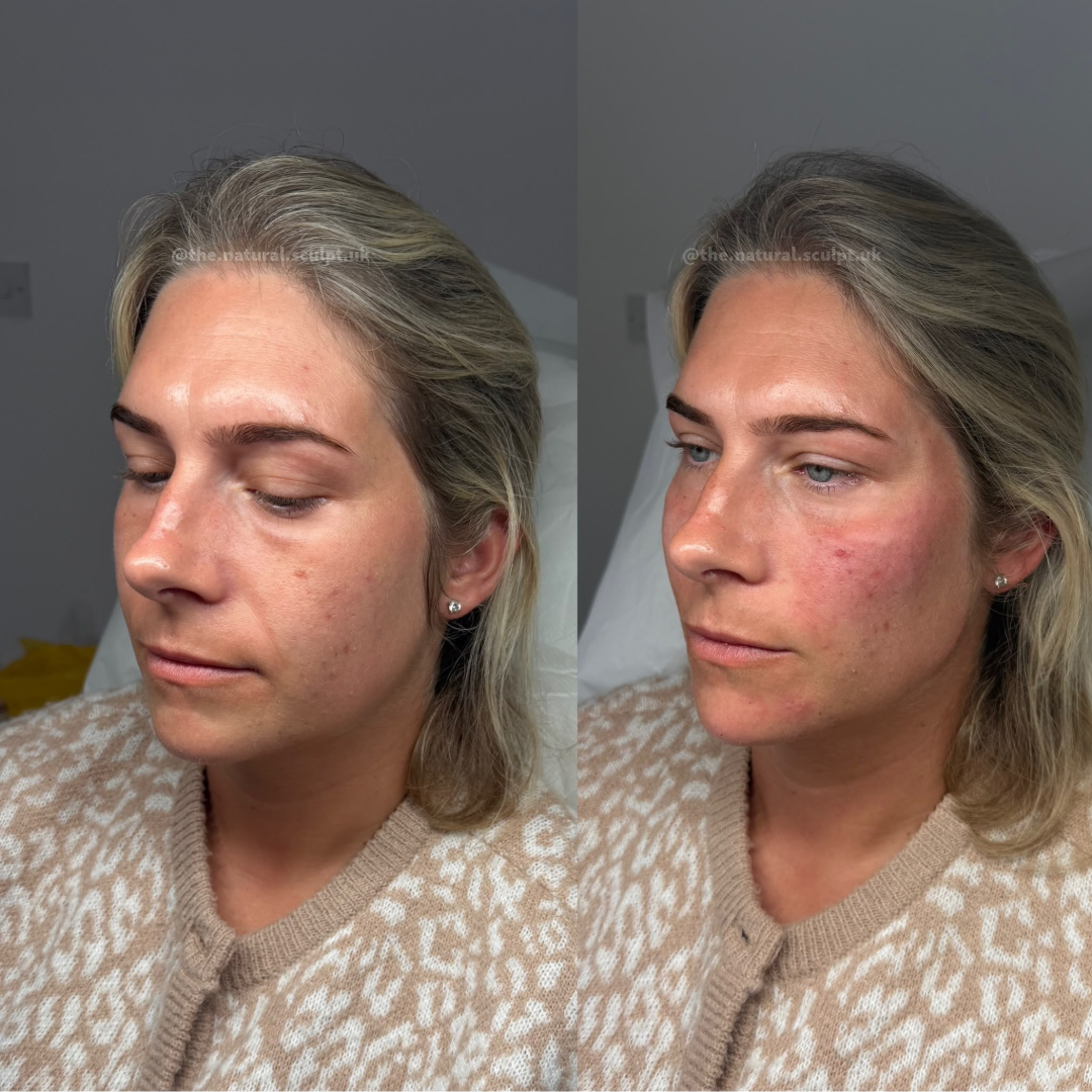Editorial three-quarter portrait showing balanced, natural facial features in soft daylight