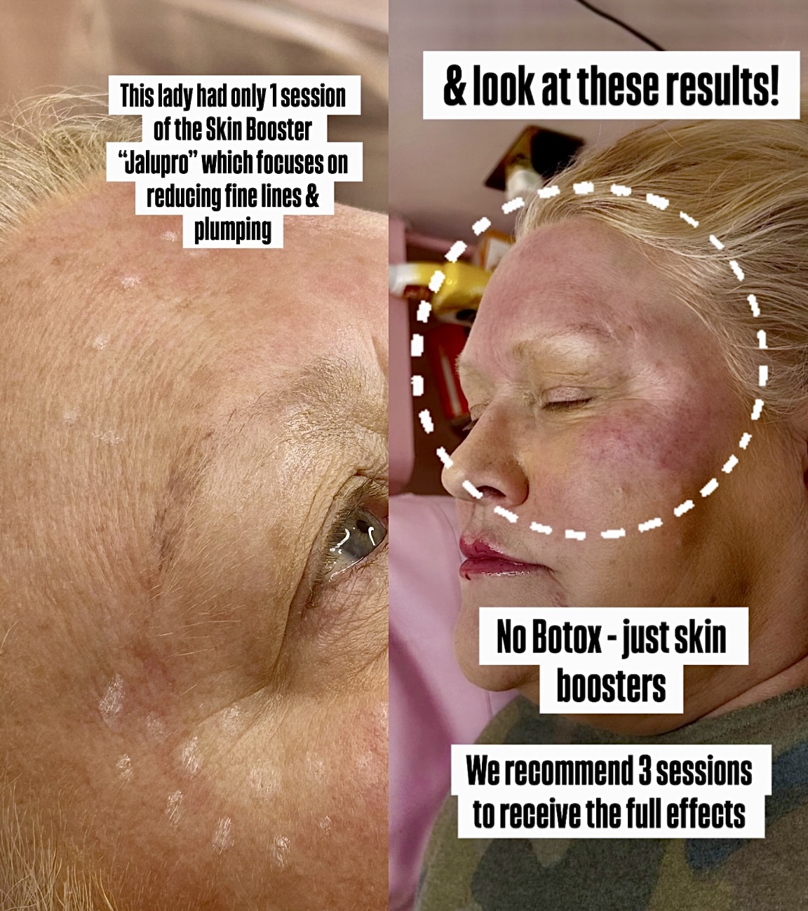 Close editorial photograph of healthy skin with natural texture
